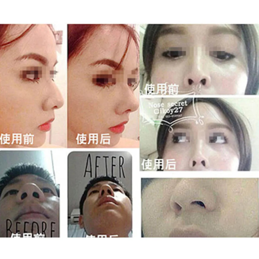 1 Set Beauty Nose Up Lifting Shaping Clip Clipper Shaper Bridge Straightening 3 Size Nose Clip Corrector Massage Tool No Pain